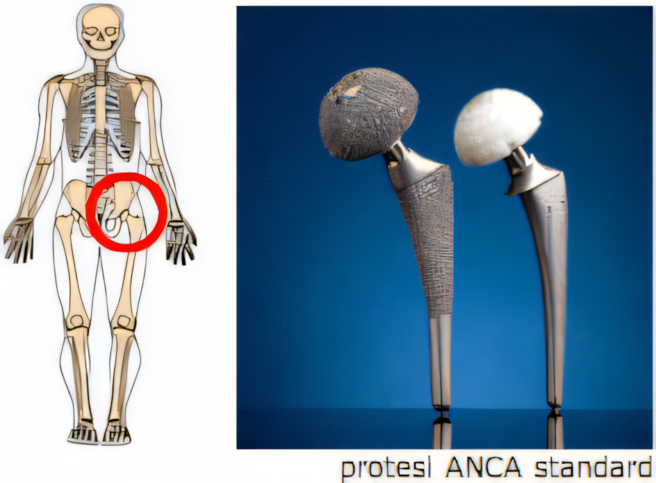 Radiografia artrosi